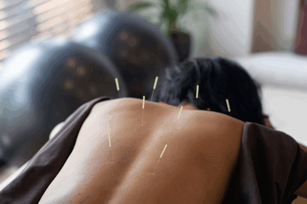 science of acupuncture